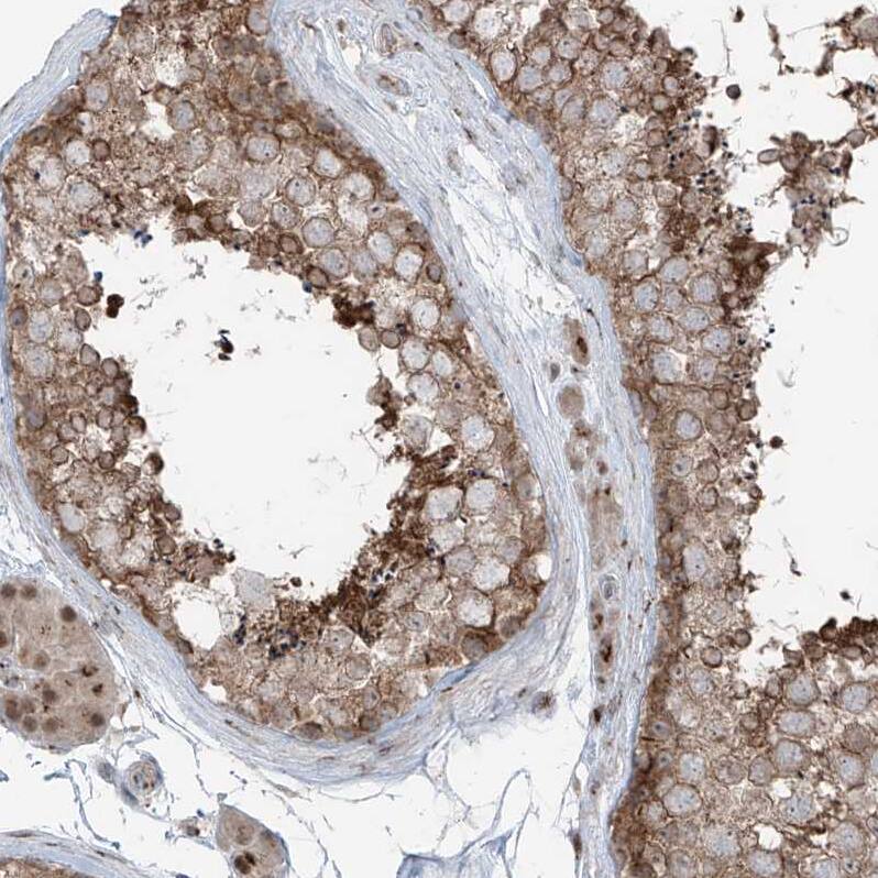 ERLEC1 Antibody - BSA Free Immunohistochemistry-Paraffin: ERLEC1 Antibody - BSA Free [NBP1-86801]