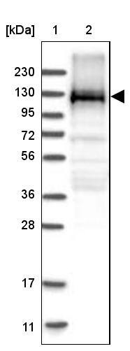 EML4 Antibody - BSA Free Western Blot: EML4 Antibody - BSA Free [NBP1-86805]