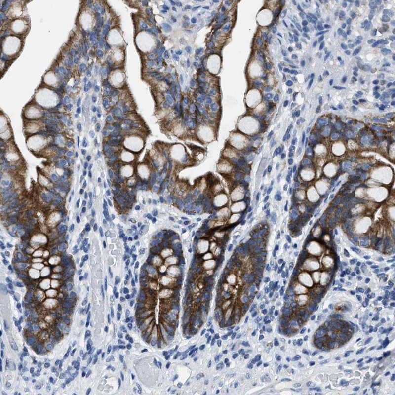 MRPL39 Antibody - BSA Free Immunohistochemistry-Paraffin: MRPL39 Antibody [NBP1-86815]