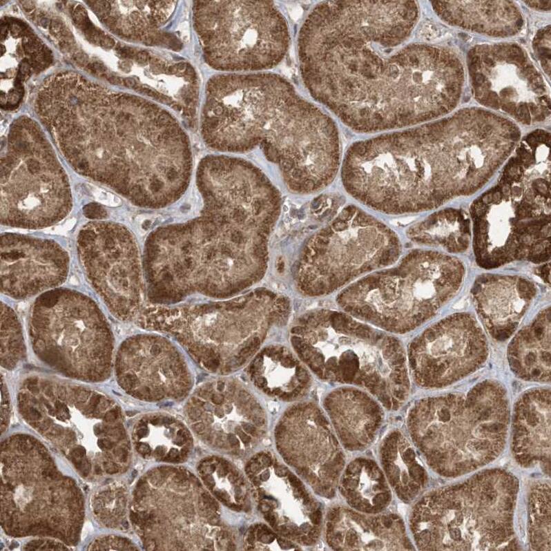 GCFC1 Antibody - BSA Free Immunohistochemistry-Paraffin: GCFC1 Antibody - BSA Free [NBP1-86818]