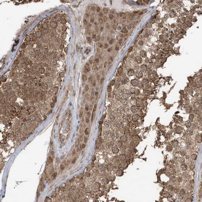 GCFC1 Antibody - BSA Free Immunohistochemistry-Paraffin: GCFC1 Antibody - BSA Free [NBP1-86818]