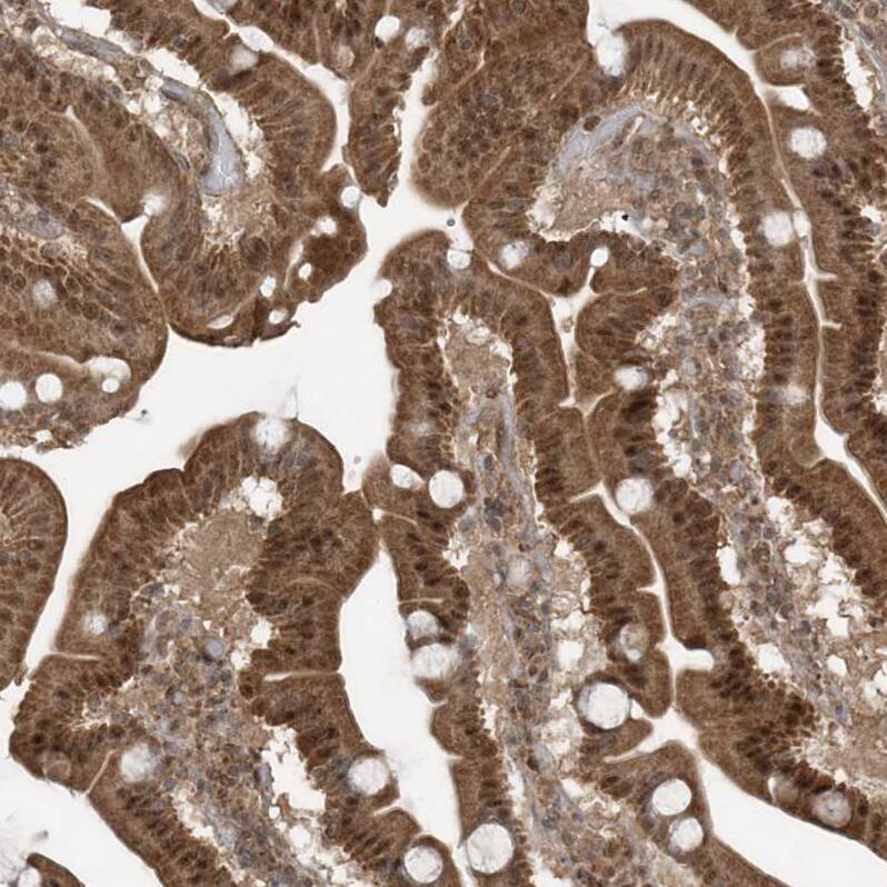 GCFC1 Antibody - BSA Free Immunohistochemistry-Paraffin: GCFC1 Antibody - BSA Free [NBP1-86818]