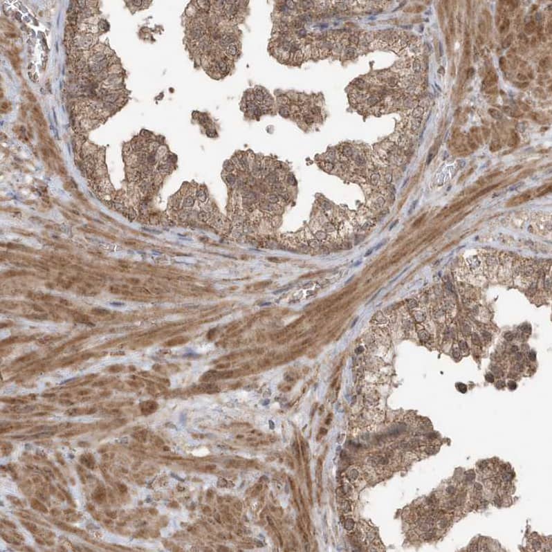 GCFC1 Antibody - BSA Free Immunohistochemistry-Paraffin: GCFC1 Antibody - BSA Free [NBP1-86818]