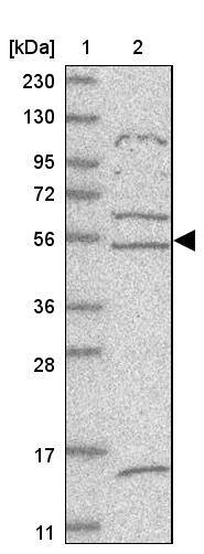 ZNF232 Antibody - BSA Free Western Blot: ZNF232 Antibody - BSA Free [NBP1-86822]