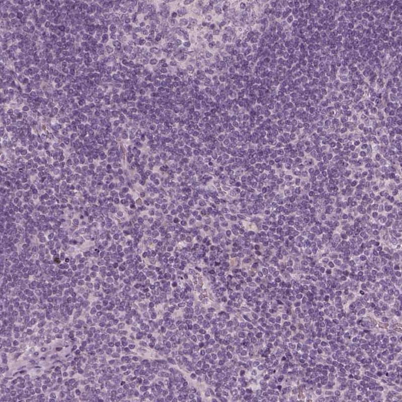 ZP4 Antibody - BSA Free Immunohistochemistry-Paraffin: ZP4 Antibody - BSA Free [NBP1-86823]