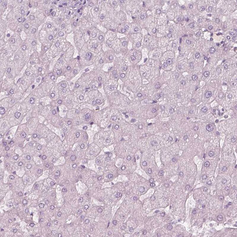 ZP4 Antibody - BSA Free Immunohistochemistry-Paraffin: ZP4 Antibody - BSA Free [NBP1-86823]