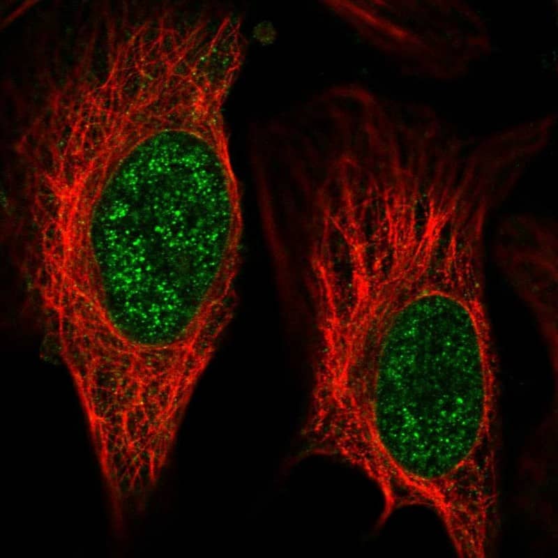 ZNF653 Antibody - BSA Free Immunocytochemistry/ Immunofluorescence: ZNF653 Antibody [NBP1-86828]