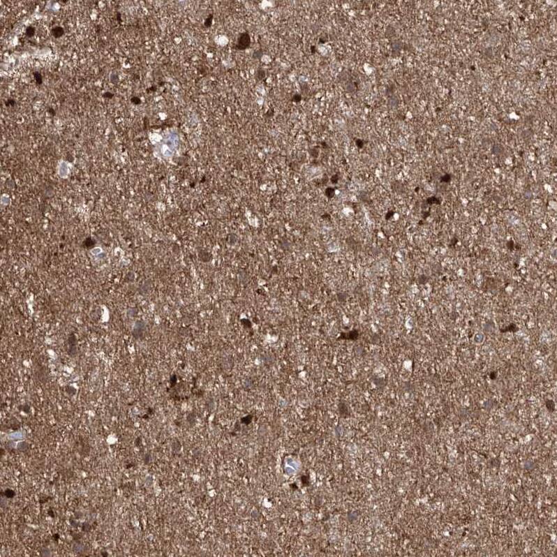 ZNF653 Antibody - BSA Free Immunohistochemistry-Paraffin: ZNF653 Antibody - BSA Free [NBP1-86828]
