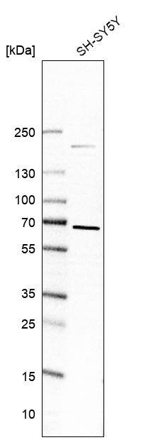 ZNF653 Antibody - BSA Free Western Blot: ZNF653 Antibody - BSA Free [NBP1-86828]