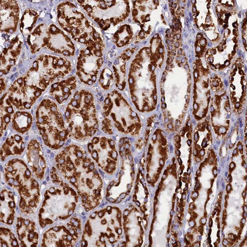 SLC39A3 Antibody - BSA Free Immunohistochemistry-Paraffin: SLC39A3 Antibody - BSA Free [NBP1-86829]