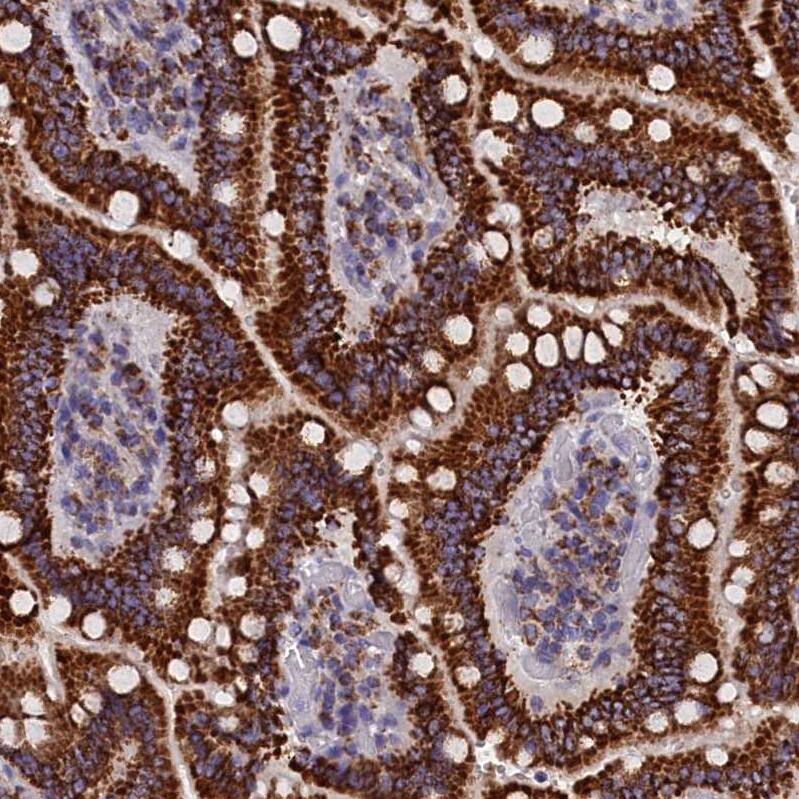 SLC39A3 Antibody - BSA Free Immunohistochemistry-Paraffin: SLC39A3 Antibody - BSA Free [NBP1-86829]