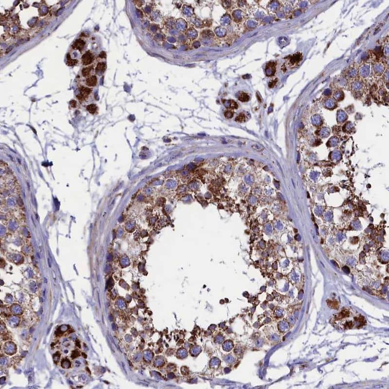 SLC39A3 Antibody - BSA Free Immunohistochemistry-Paraffin: SLC39A3 Antibody - BSA Free [NBP1-86829]