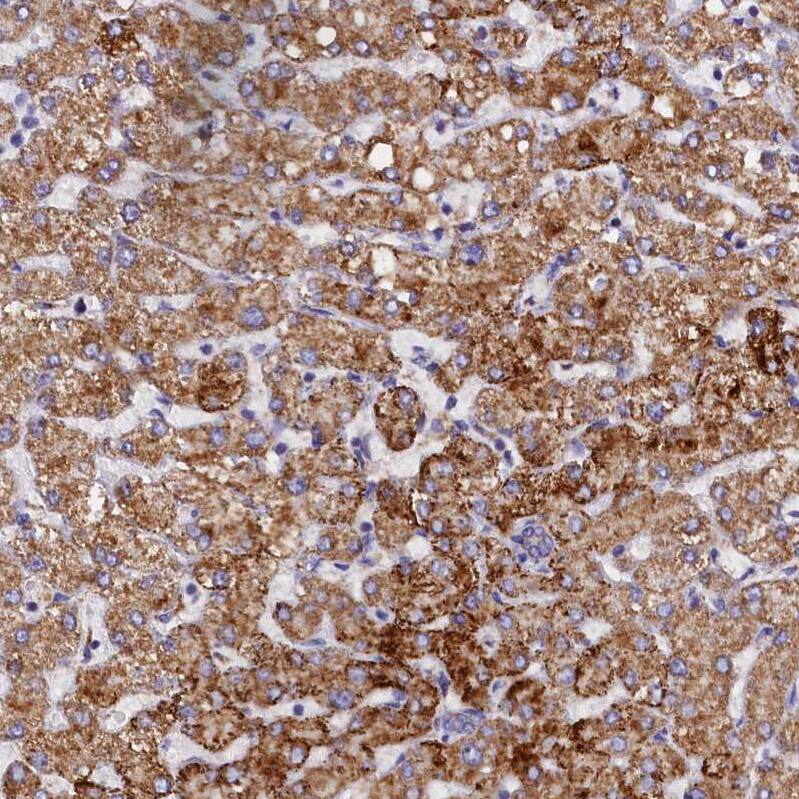 SLC39A3 Antibody - BSA Free Immunohistochemistry-Paraffin: SLC39A3 Antibody - BSA Free [NBP1-86829]