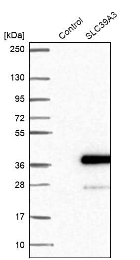 SLC39A3 Antibody - BSA Free Western Blot: SLC39A3 Antibody - BSA Free [NBP1-86829]