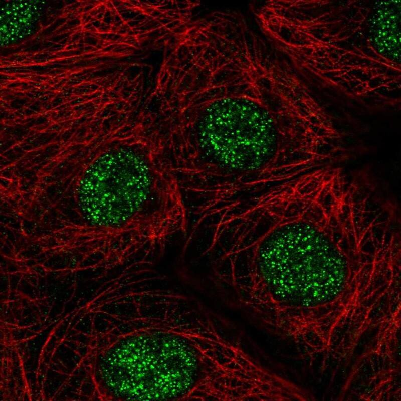 ZIC1 Antibody - BSA Free Immunocytochemistry/ Immunofluorescence: ZIC1 Antibody [NBP1-86833]