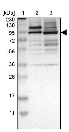 ZFP95 Antibody - BSA Free Western Blot: ZFP95 Antibody - BSA Free [NBP1-86834]