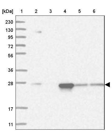 Proteasome 20S alpha 5 Antibody - BSA Free Western Blot: Proteasome 20S alpha 5 Antibody - BSA Free [NBP1-86837]