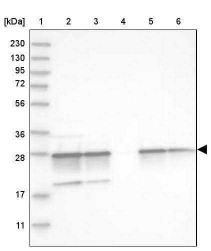 Proteasome 20S alpha 5 Antibody - BSA Free Western Blot: Proteasome 20S alpha 5 Antibody - BSA Free [NBP1-86838]