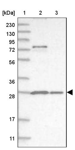 Proteasome 20S alpha 5 Antibody - BSA Free Western Blot: Proteasome 20S alpha 5 Antibody - BSA Free [NBP1-86839]