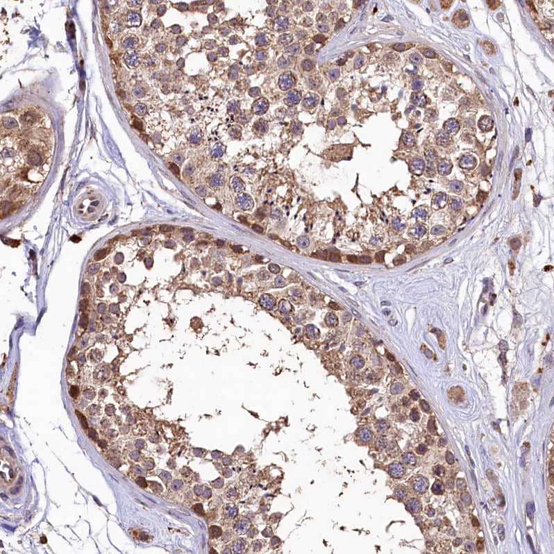 LSM4 Antibody - BSA Free Immunohistochemistry-Paraffin: LSM4 Antibody [NBP1-86846]