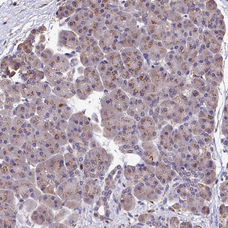 LSM4 Antibody - BSA Free Immunohistochemistry-Paraffin: LSM4 Antibody [NBP1-86846]