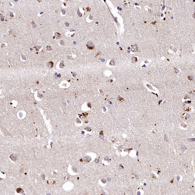 LSM4 Antibody - BSA Free Immunohistochemistry-Paraffin: LSM4 Antibody [NBP1-86846]