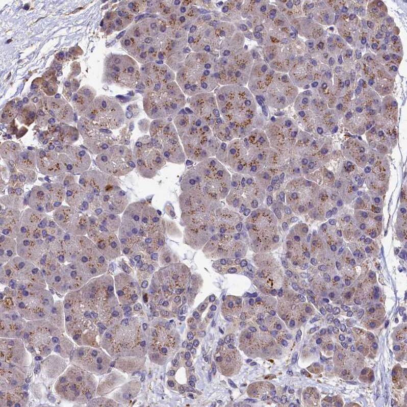LSM4 Antibody - BSA Free Immunohistochemistry-Paraffin: LSM4 Antibody - BSA Free [NBP1-86846]