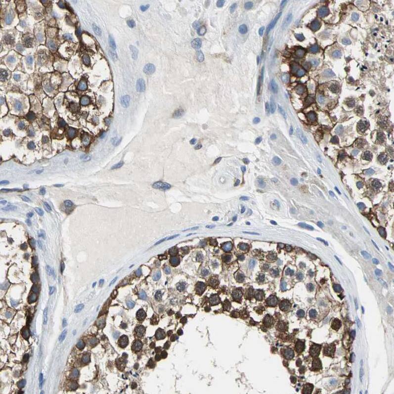 Tight Junction Protein 2 Antibody - BSA Free Immunohistochemistry-Paraffin: Tight Junction Protein 2 Antibody - BSA Free [NBP1-86850]