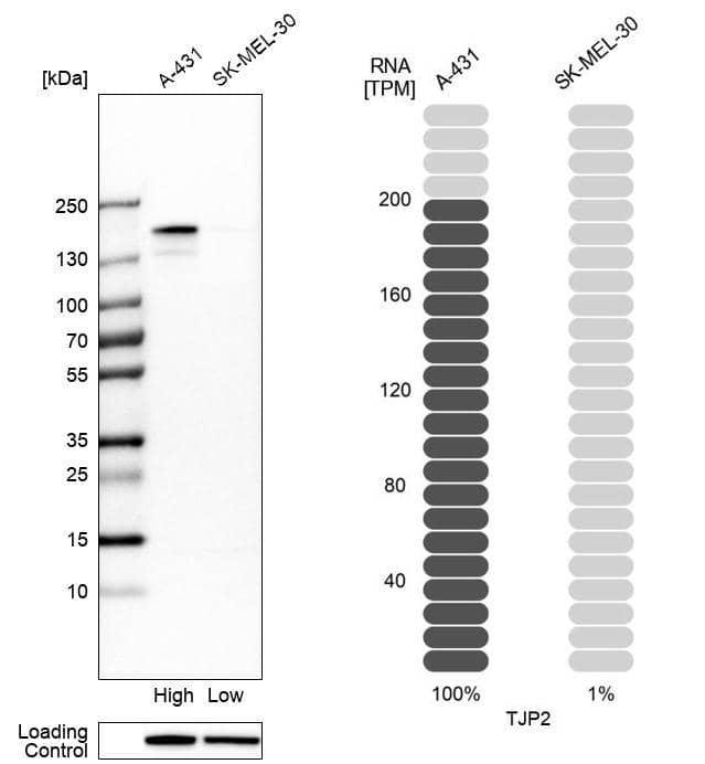 Tight Junction Protein 2 Antibody - BSA Free Western Blot: Tight Junction Protein 2 Antibody - BSA Free [NBP1-86850]