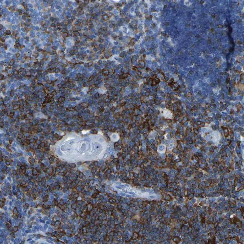 LSP1 Antibody - BSA Free Immunohistochemistry-Paraffin: LSP1 Antibody - BSA Free [NBP1-86852]