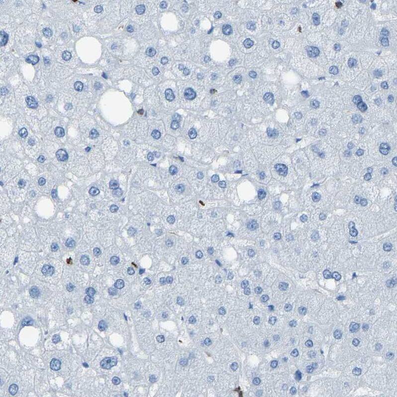 LSP1 Antibody - BSA Free Immunohistochemistry-Paraffin: LSP1 Antibody - BSA Free [NBP1-86852]