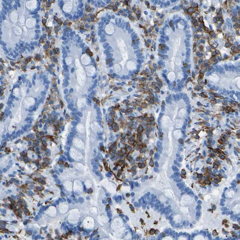 LSP1 Antibody - BSA Free Immunohistochemistry-Paraffin: LSP1 Antibody - BSA Free [NBP1-86852]