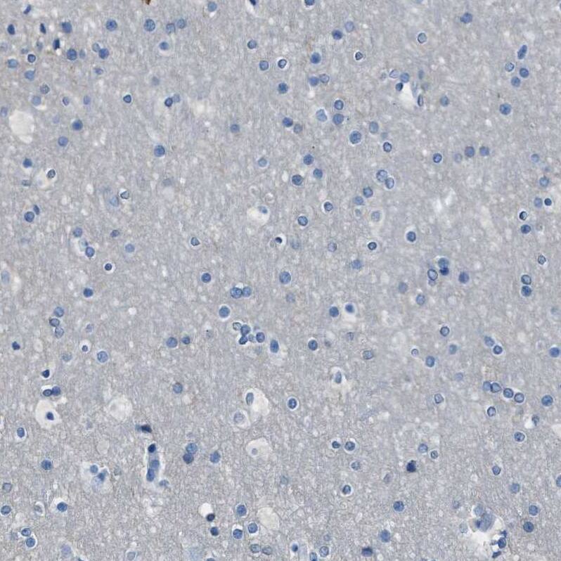 LSP1 Antibody - BSA Free Immunohistochemistry-Paraffin: LSP1 Antibody - BSA Free [NBP1-86852]