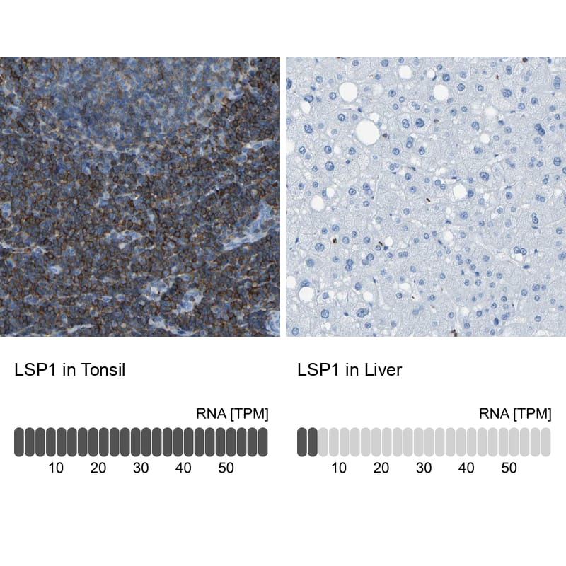 LSP1 Antibody - BSA Free Immunohistochemistry-Paraffin: LSP1 Antibody - BSA Free [NBP1-86852]
