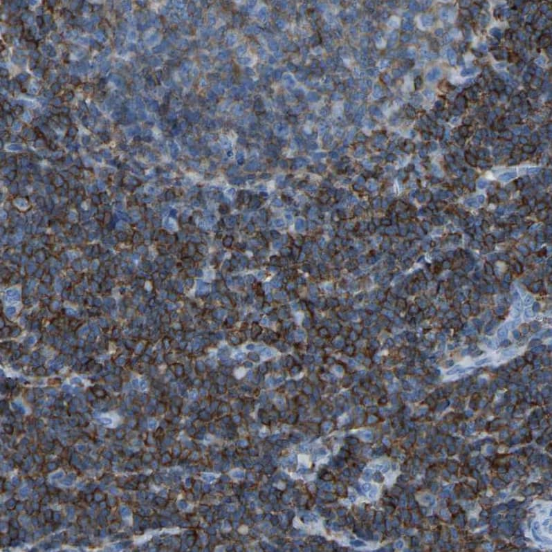 LSP1 Antibody - BSA Free Immunohistochemistry-Paraffin: LSP1 Antibody - BSA Free [NBP1-86852]