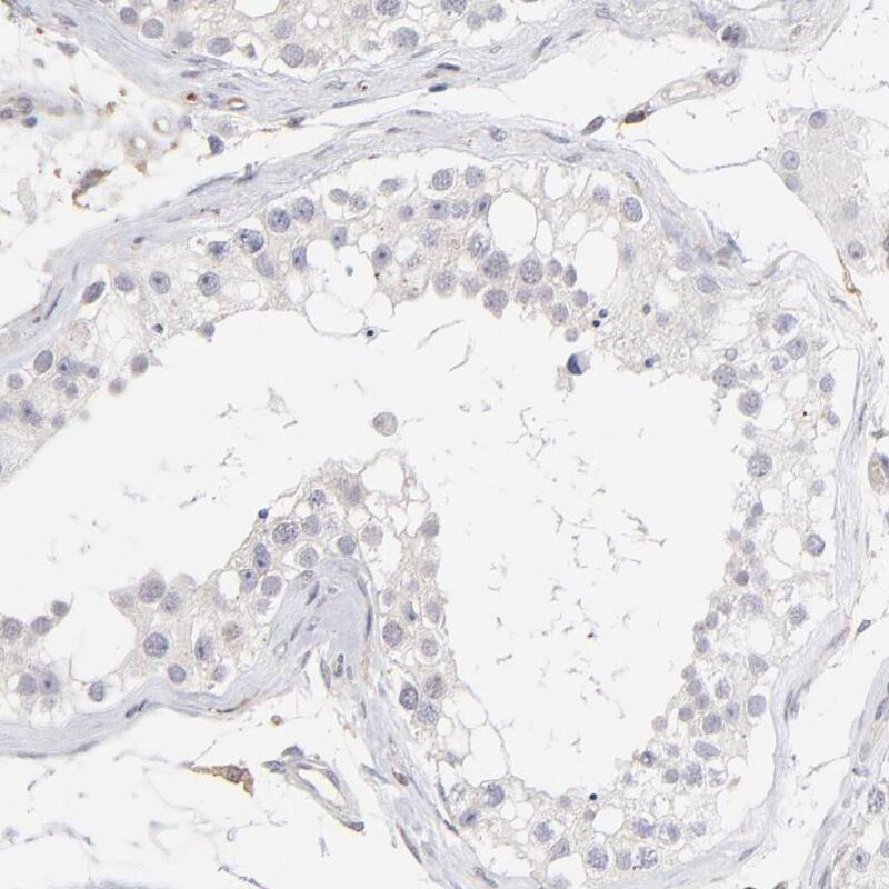 WIPF1/WIP Antibody - BSA Free Immunohistochemistry-Paraffin: WIPF1/WIP Antibody - BSA Free [NBP1-86859]