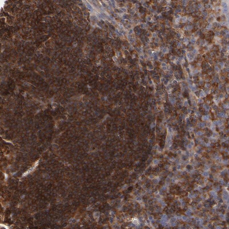 WIPF1/WIP Antibody - BSA Free Immunohistochemistry-Paraffin: WIPF1/WIP Antibody - BSA Free [NBP1-86859]