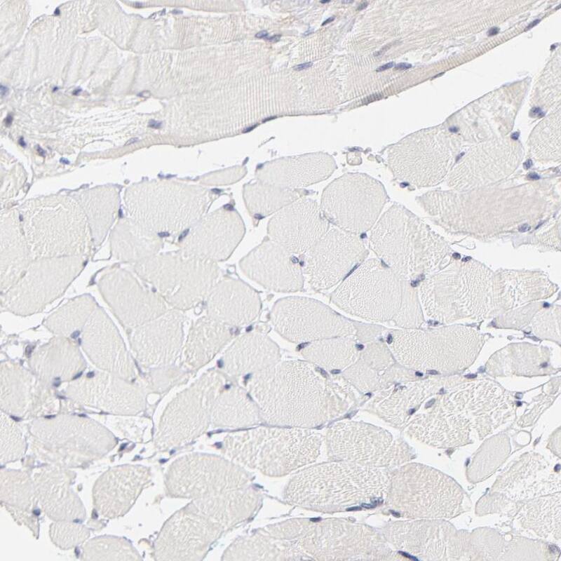 WIPF1/WIP Antibody - BSA Free Immunohistochemistry-Paraffin: WIPF1/WIP Antibody - BSA Free [NBP1-86859]