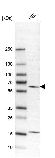 WIPF1/WIP Antibody - BSA Free Western Blot: WIPF1/WIP Antibody - BSA Free [NBP1-86859]