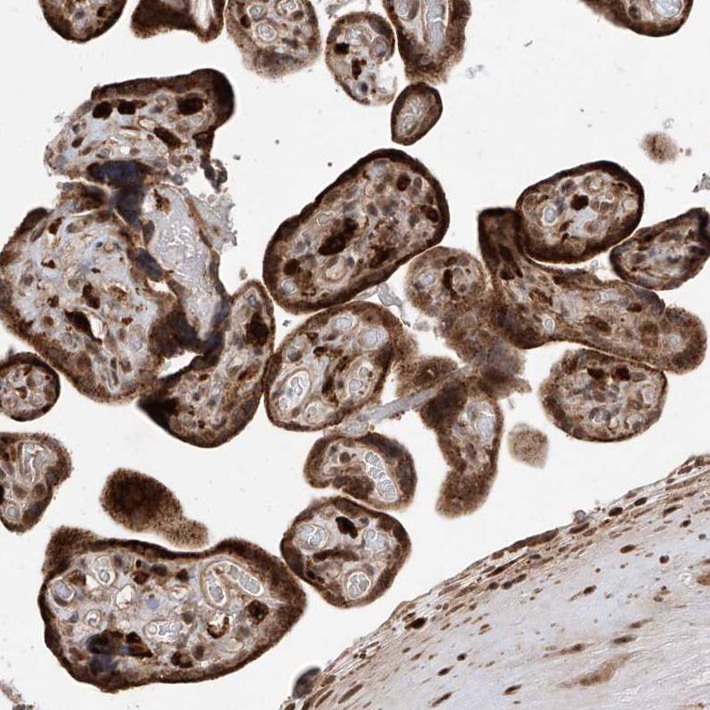 LATS1 Antibody - BSA Free Immunohistochemistry-Paraffin: LATS1 Antibody [NBP1-86860]