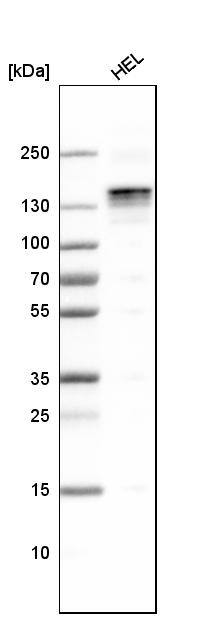 LATS1 Antibody - BSA Free Western Blot: LATS1 Antibody - BSA Free [NBP1-86860]