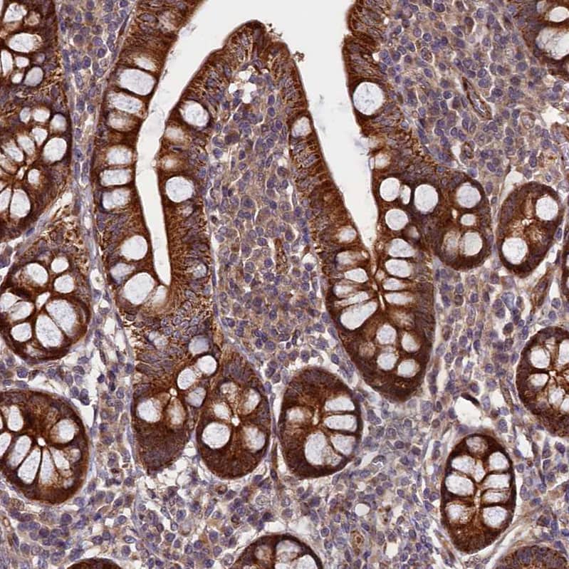 VPS34 Antibody - BSA Free Immunohistochemistry-Paraffin: VPS34 Antibody - BSA Free [NBP1-86862]