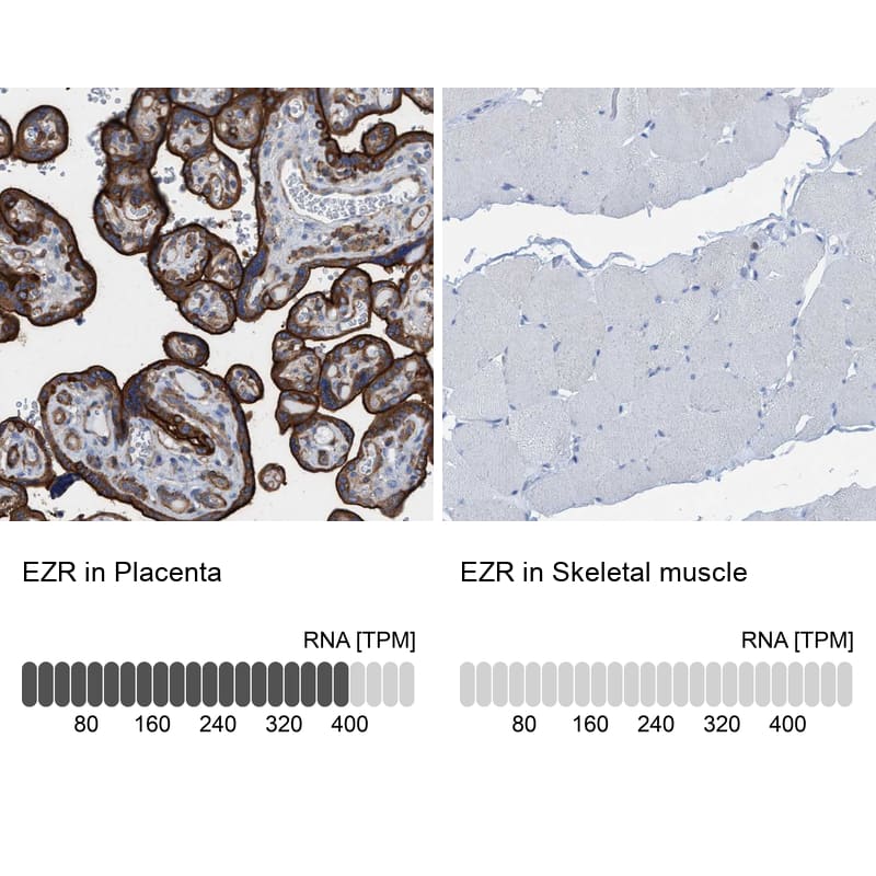 Ezrin Antibody - BSA Free Immunohistochemistry-Paraffin: Ezrin Antibody - BSA Free [NBP1-86863]