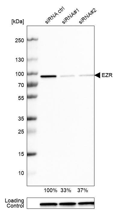 Ezrin Antibody - BSA Free Western Blot: Ezrin Antibody - BSA Free [NBP1-86863]