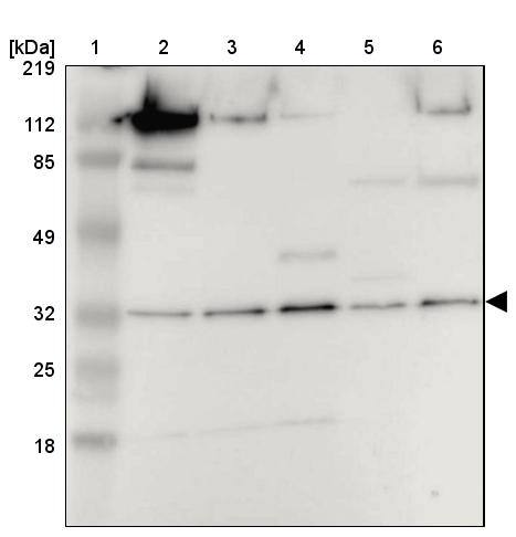 PITPNB Antibody - BSA Free Western Blot: PITPNB Antibody - BSA Free [NBP1-86864]