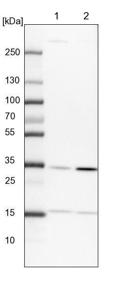 PITPNB Antibody - BSA Free Western Blot: PITPNB Antibody - BSA Free [NBP1-86864]