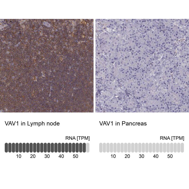 Vav-1 Antibody - BSA Free Immunohistochemistry-Paraffin: Vav-1 Antibody - BSA Free [NBP1-86867]