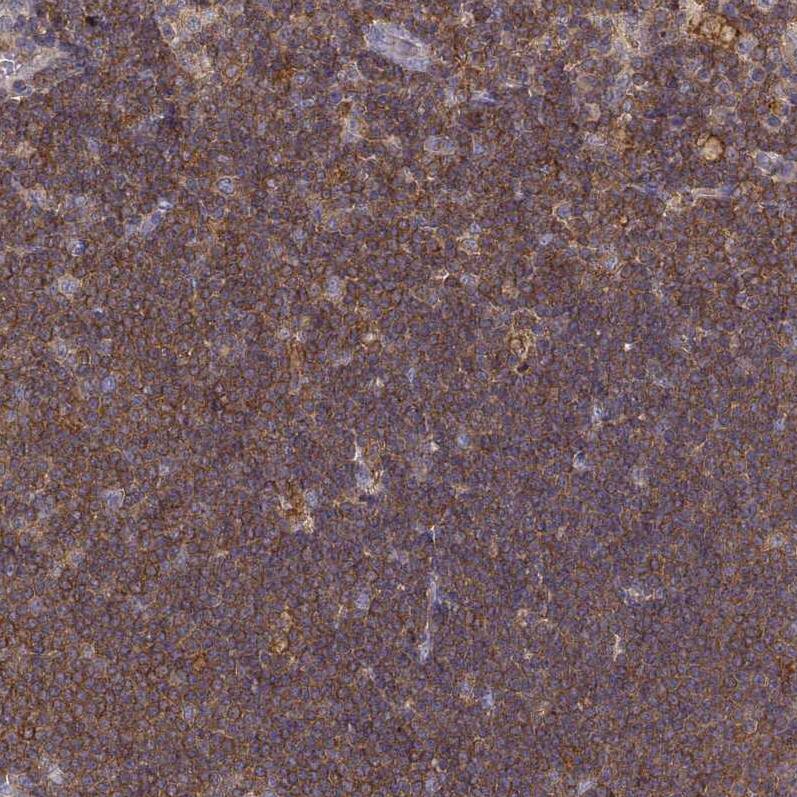 Vav-1 Antibody - BSA Free Immunohistochemistry-Paraffin: Vav-1 Antibody - BSA Free [NBP1-86867]