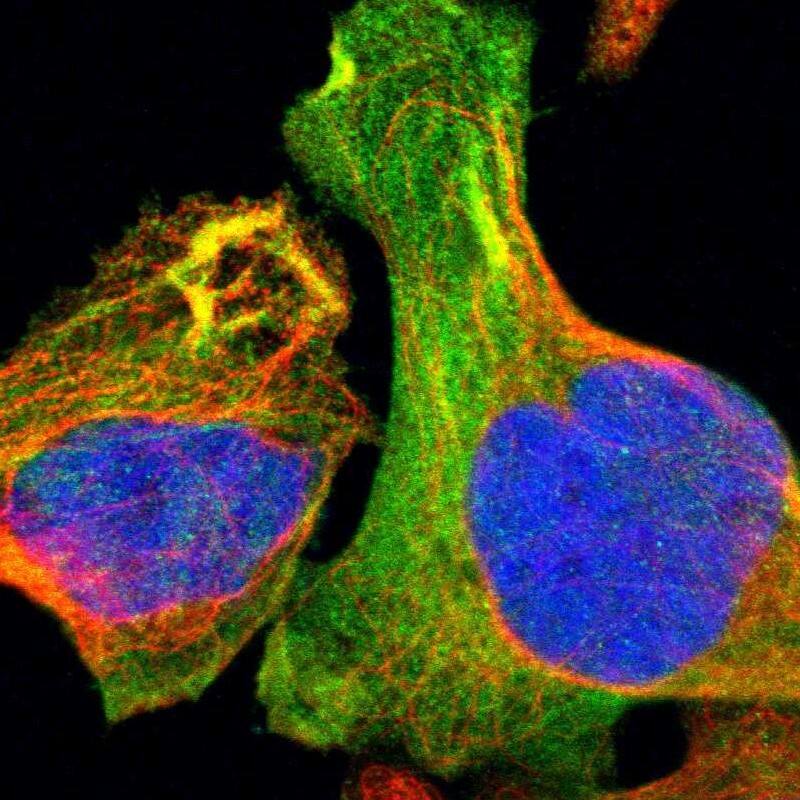 Tropomodulin 3 Antibody - BSA Free Immunocytochemistry/ Immunofluorescence: Tropomodulin 3 Antibody [NBP1-86870]