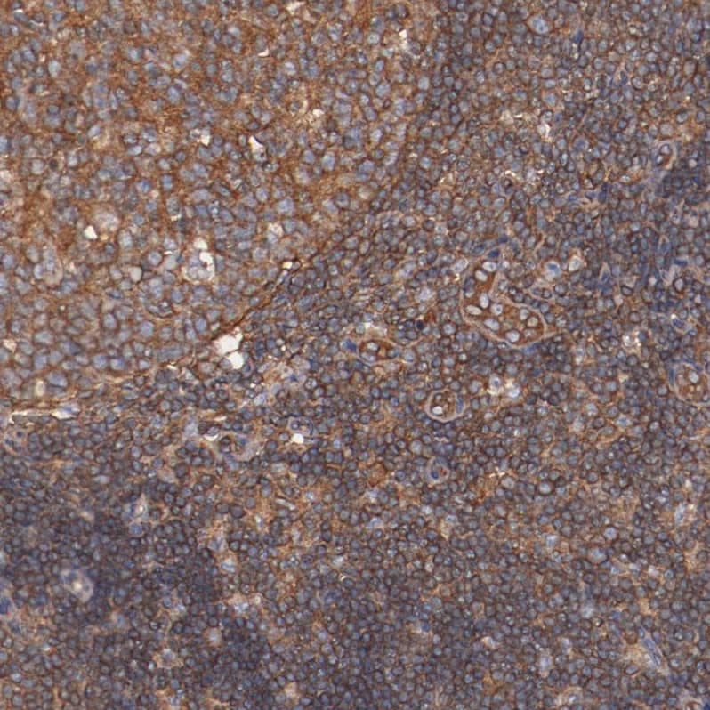 Tropomodulin 3 Antibody - BSA Free Immunohistochemistry-Paraffin: Tropomodulin 3 Antibody - BSA Free [NBP1-86870]